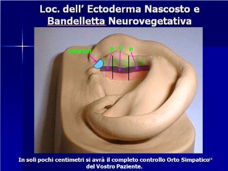 Corso Online di Auricoloterapia II livello. Dr. Ventura - Moncalieri (To)