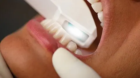 dentista con scanner intraorale a Moncalieri